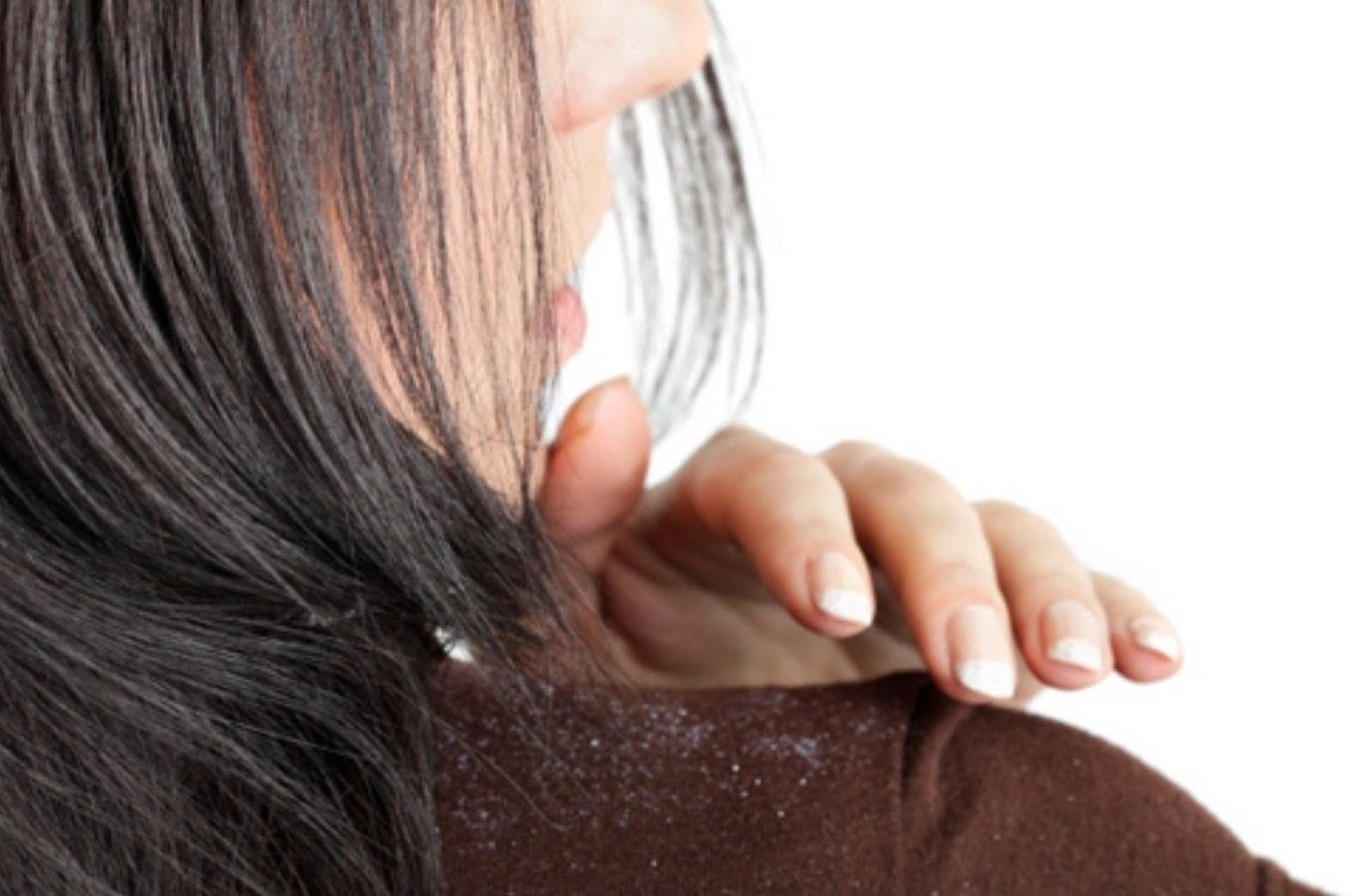 перхоть подстричься