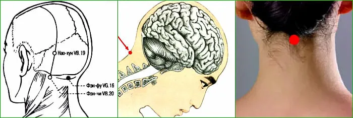 Точки на голове от головной боли фото с расшифровкой