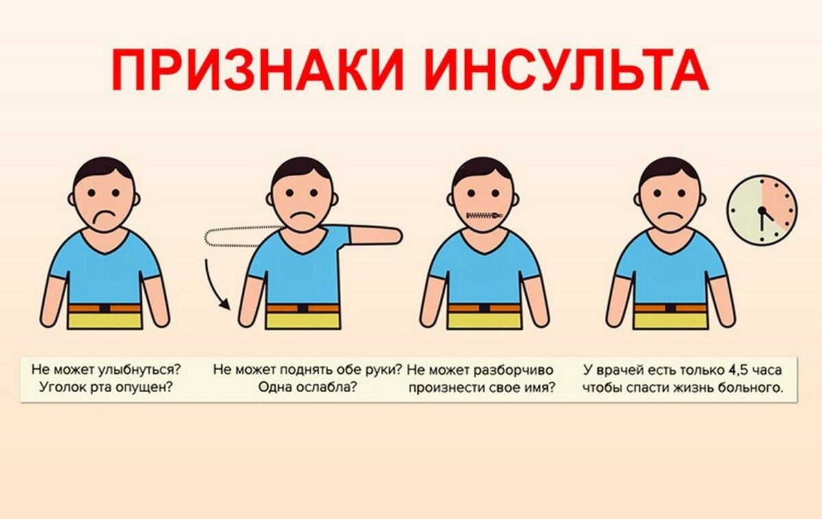 Распознавание симптомов инсульта. Признаки инсульта. Распознавание признаков инсульта. Признаки инсульта. Инсульт симптомы первые.