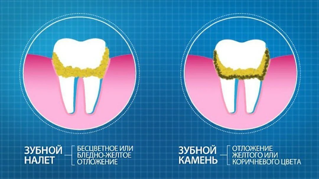 Чем отличаются стоматологи