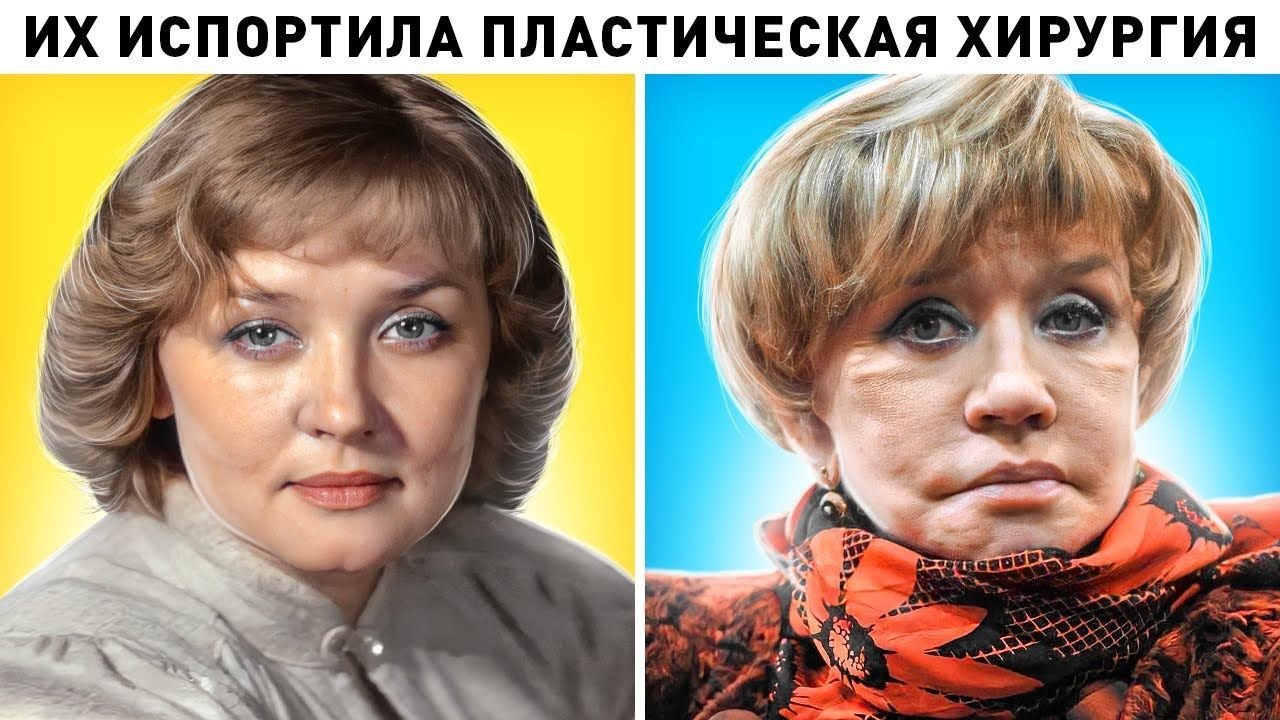 Ольга Богданова актриса пластические операции