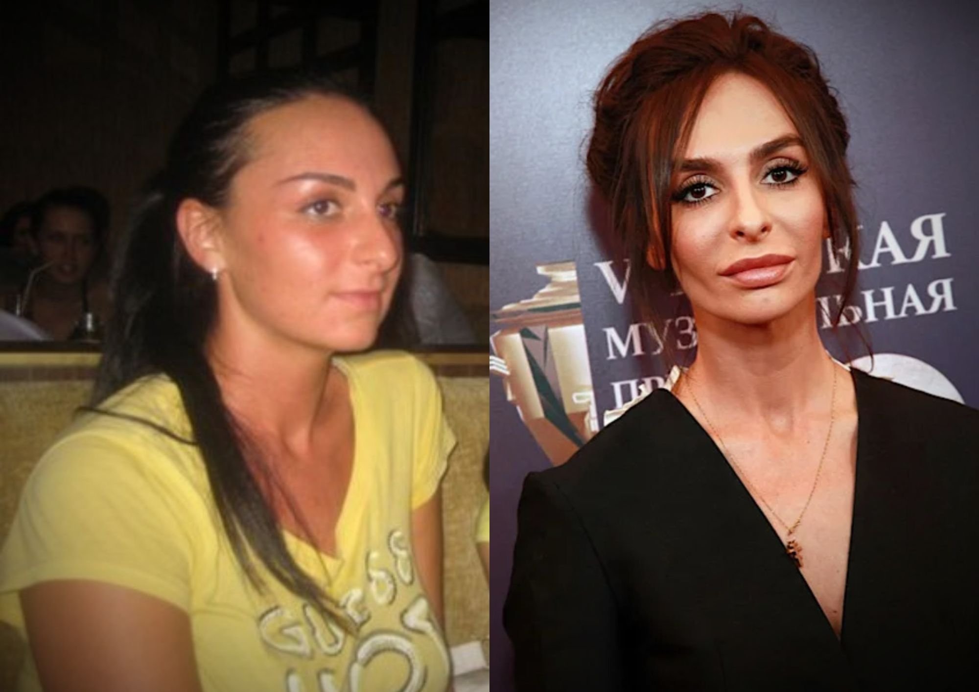 Екатерина Варнава до и после пластики глаз