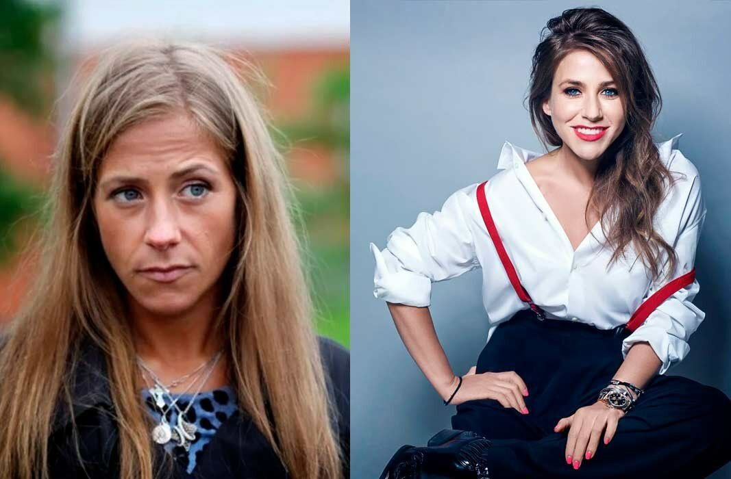 Юлия барановская фото до и после пластики