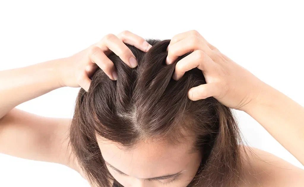 Как защитить волосы и кожу головы
