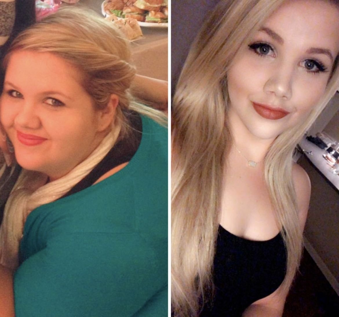 Лицо до и после похудения на 20 кг
