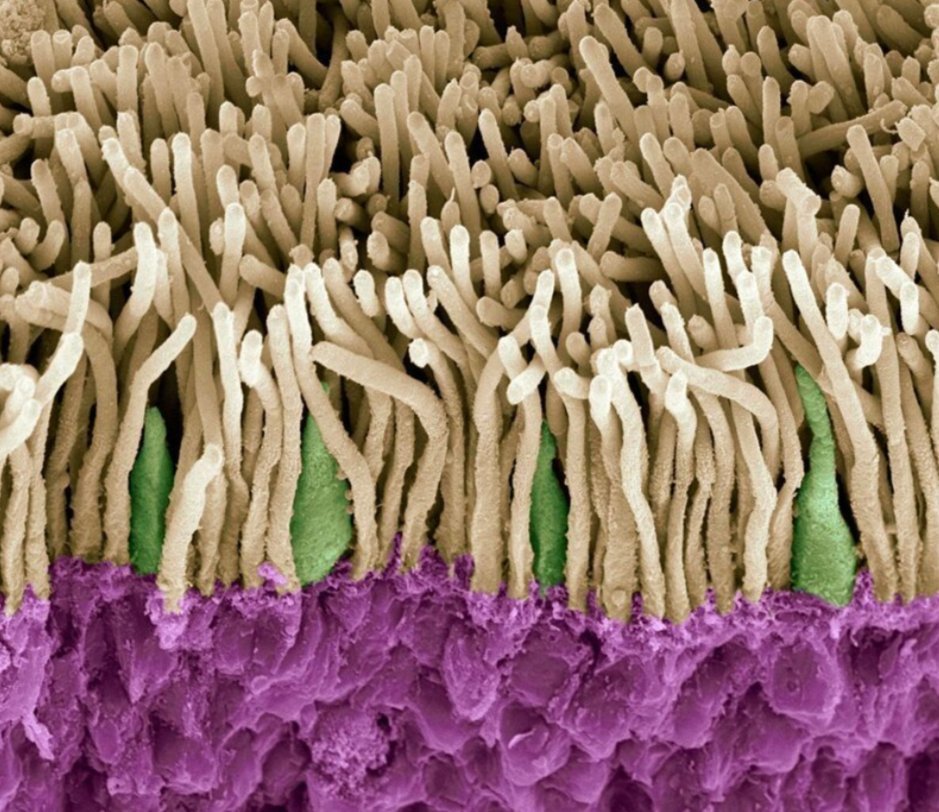 Фото волосы под микроскопом фото