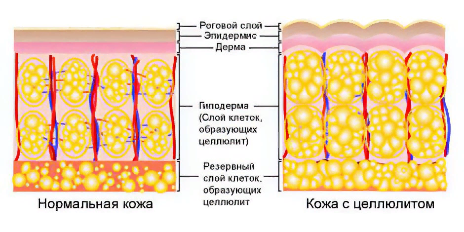 Состоит из фиброзной и жировой капсулы