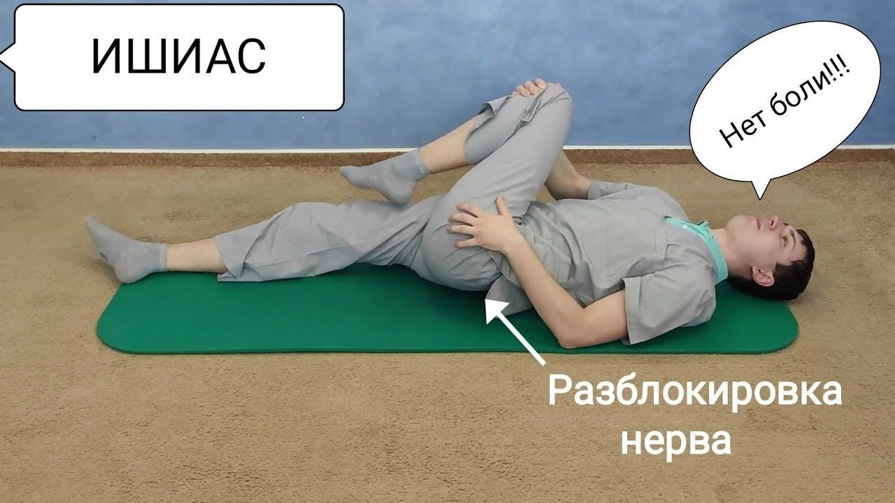 Защемление седалищного нерва - Синдром грушевидной мышцы, ишиас ...