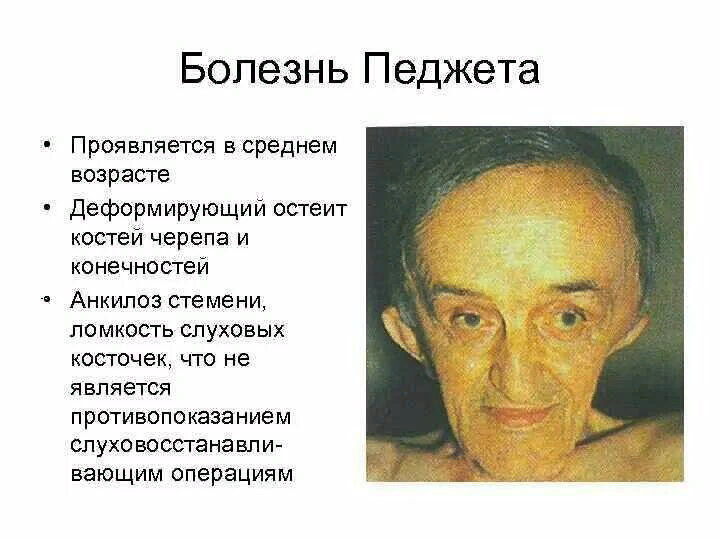 Заболевания челюстных костей - презентация онлайн