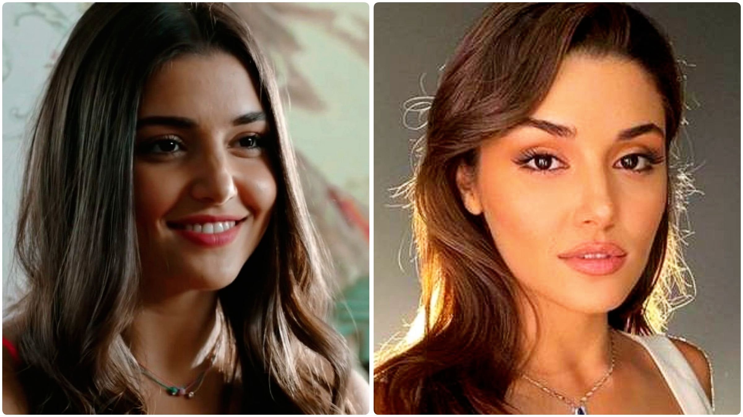 Ханде эрчел пластическая операция. Ханде эрчел блефаропластика. Актриса ханде эрчел пластика. Ханде эрчел 2022. Какие операции делала ханде.