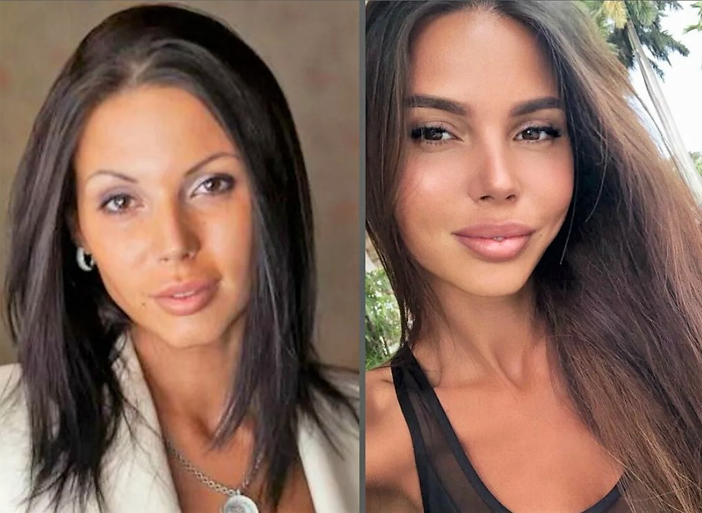 малиновская маша до после губы. меган фокс скулы. виктория боня до операций. маша малиновская пластика губ. оксана самойлова до.