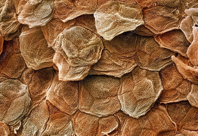 Микро кожи. Ороговевшие мертвые клетки слой кожи. Роговой слой кожи под микроскопом. Роговой слой эпидермиса под микроскопом. Эпидерма под микроскопом.