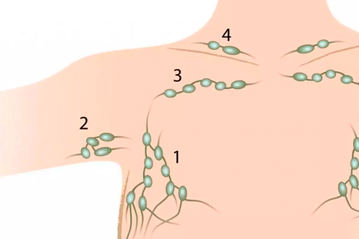 расположение лимфоузлов в груди у женщин фото 76