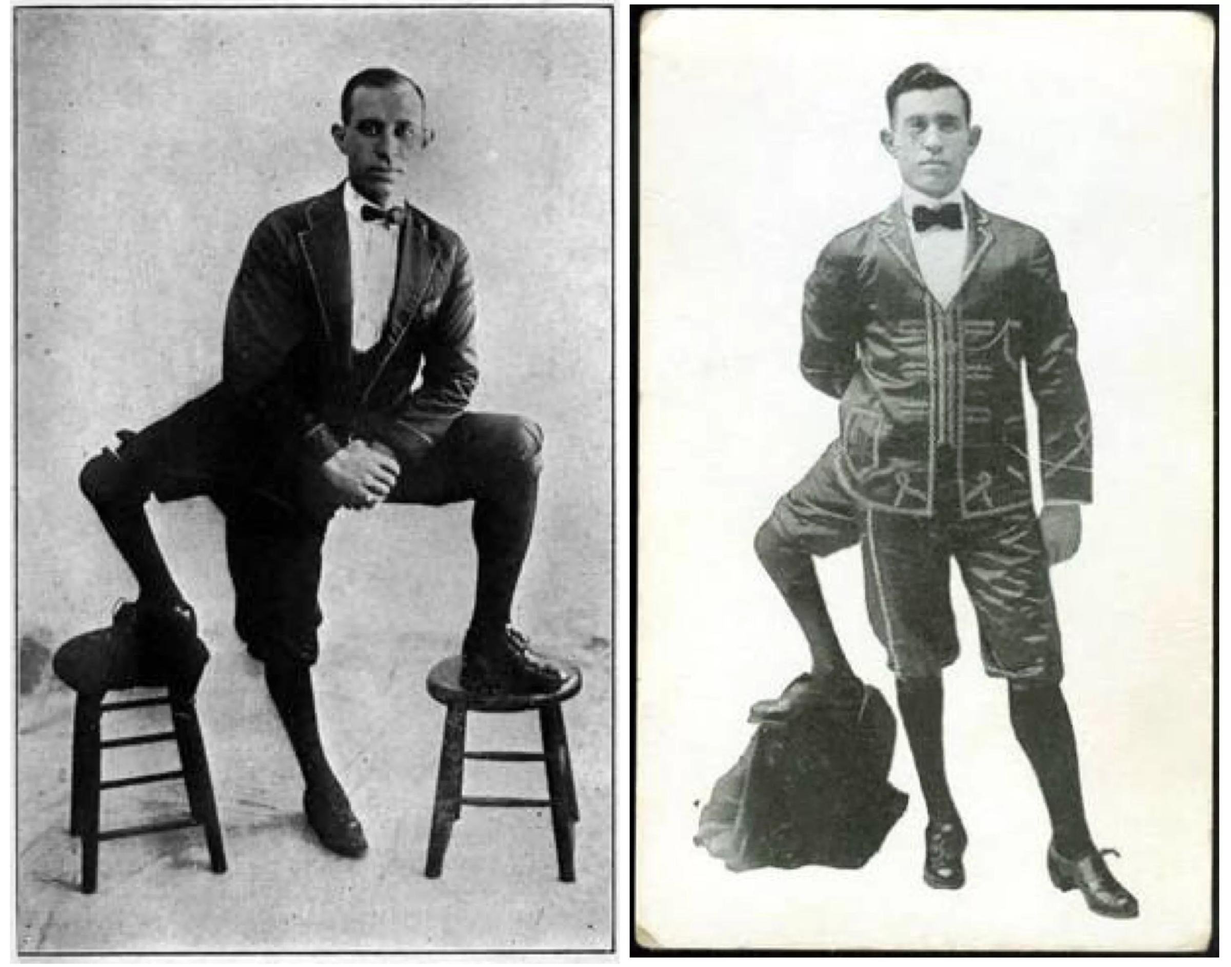 Папа 3 ноги. Франческо (фрэнк) лентини. Трёхногий фрэнк лентини. 1889. Дэдди лонг легс поппи плейтайм.