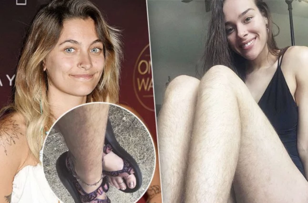 почему у женщин волосатые ноги фото 10