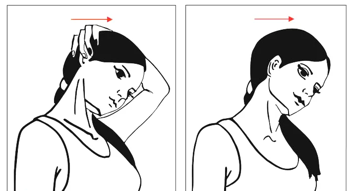 Наклон головы вперед рисунок