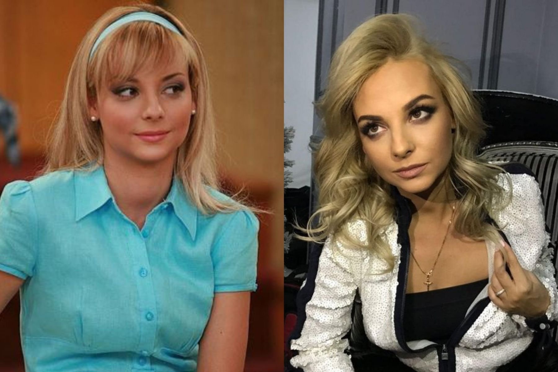 Дарья Сагалова до и после фото пластики