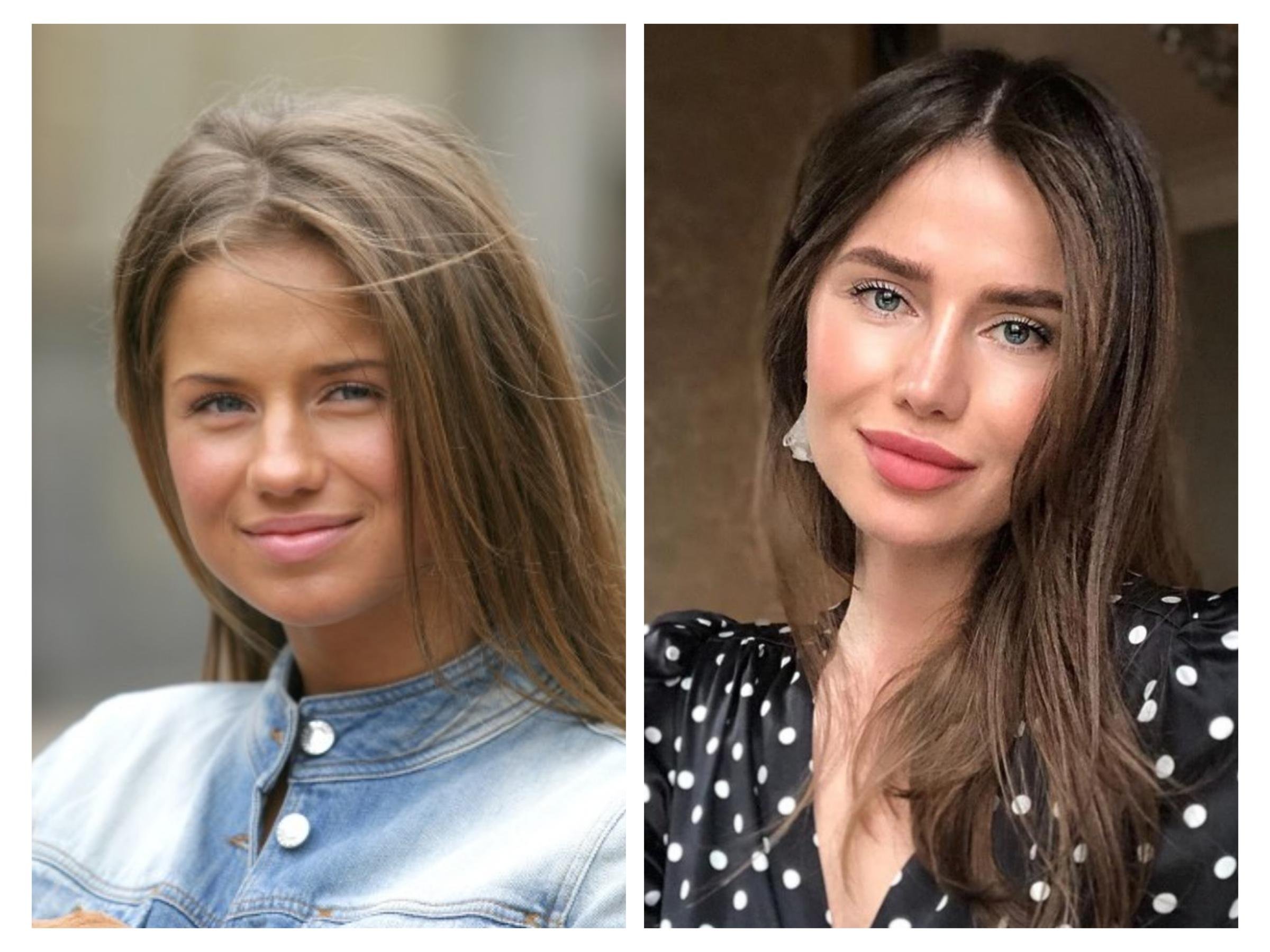 Русские звезды до и после пластики фото