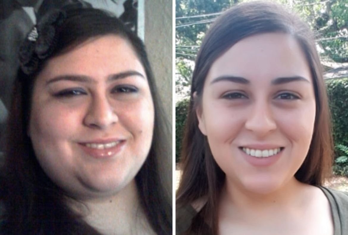 Лицо после похудения до и после