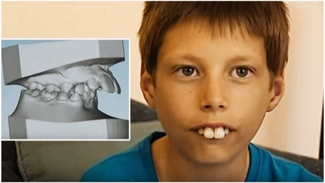 Самый большой зуб в мире у человека фото