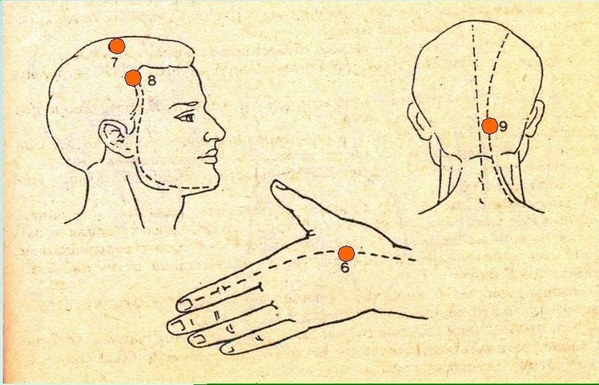 Какую точку массировать при головной. Точки при головной боли. Точки массажа при головной боли. Точечный массаж при головной боли. Точки на голове для массажа при головной боли.