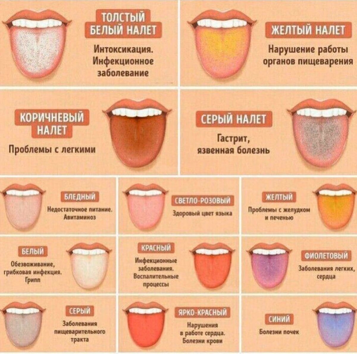 Салатовый язык. Налет на языке о чем говорит. По цвету языка определить болезни.