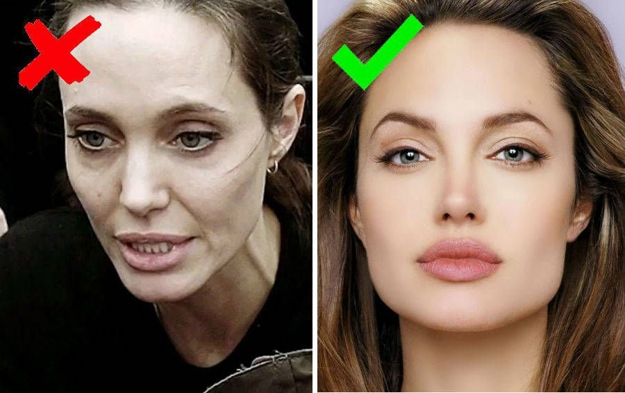 Почему виден возраст. Скулы Джоли. Анджелина Джоли впалые щеки. Джоли Джоли скулы. Скулы Анджелины Джоли.