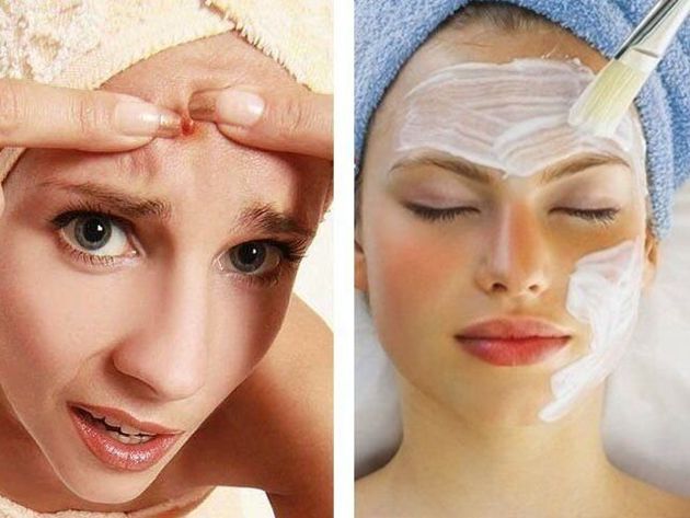 Чистая и гладкая кожа: топ - 5 домашних масок для лица, которые помогут быстро избавиться от прыщей