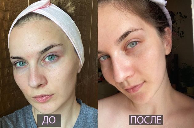 Полезно знать красоткам: лучший способ, как за 30 минут сделать кожу молодой и свежей без помощи косметолога