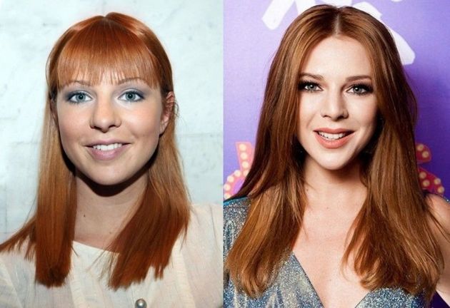 10 российских звёзд, которые удачно изменили форму носа и стали красивее