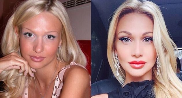 10 российских звёзд, которые удачно изменили форму носа и стали красивее