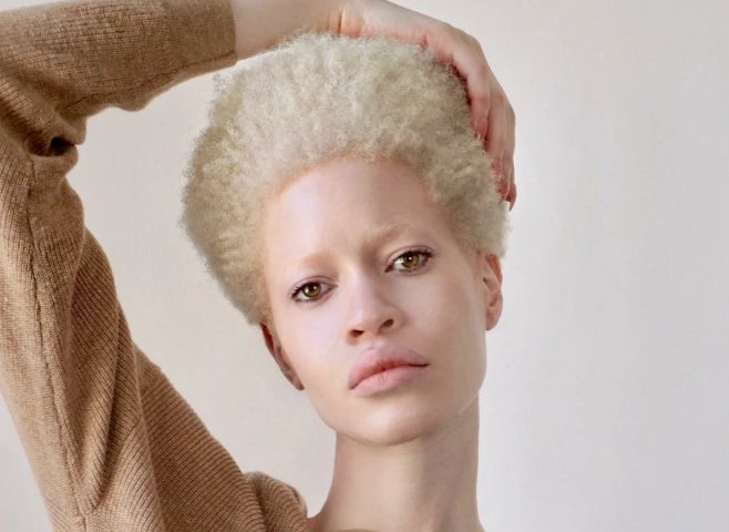 Диандра Форрест: афроамериканская модель-альбинос | О женщинах | Пульс  Mail.ru