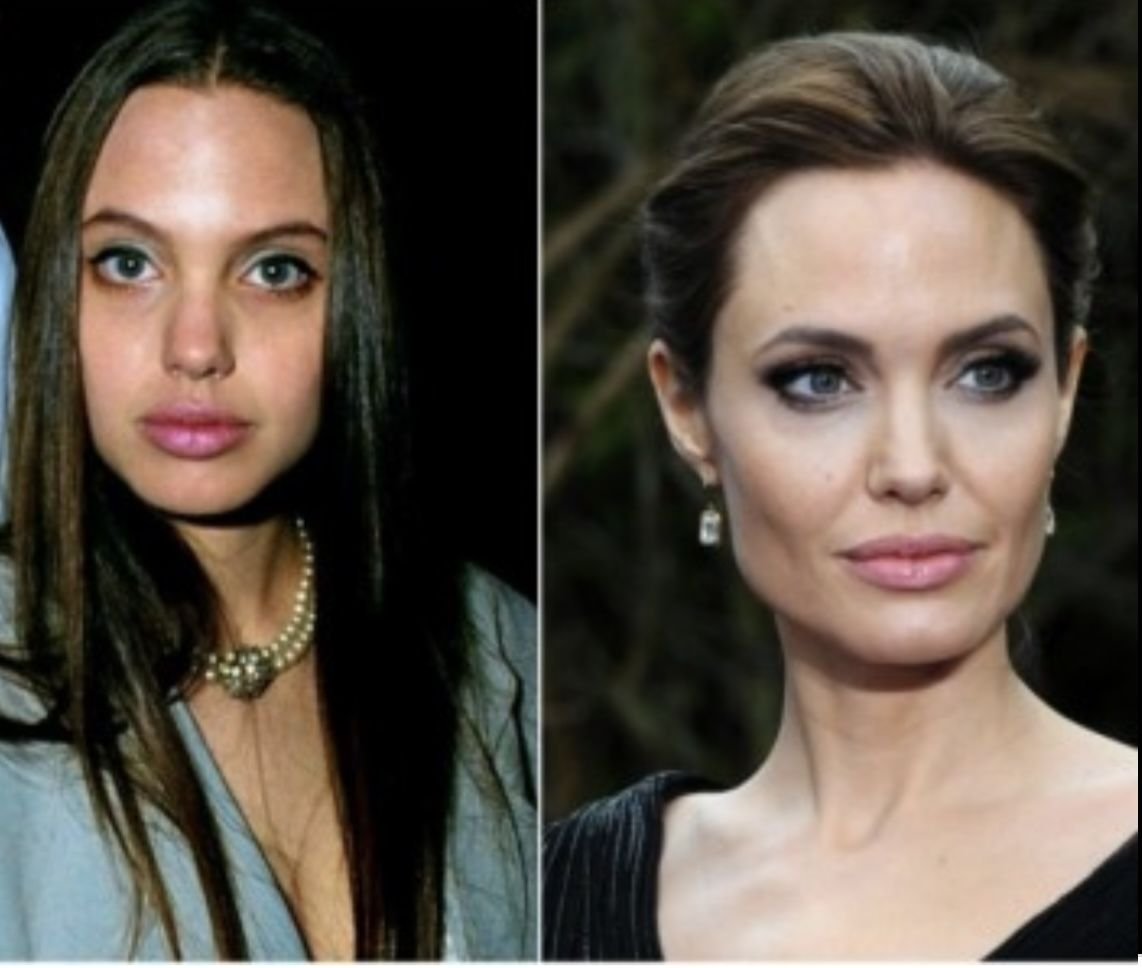 Бывший реально изменился. Анджелина Джоли ринопластика. Анджелина Джоли до пластики. Анжелина Джоли до и после пластики. Анджелина Джоли до операции и после.