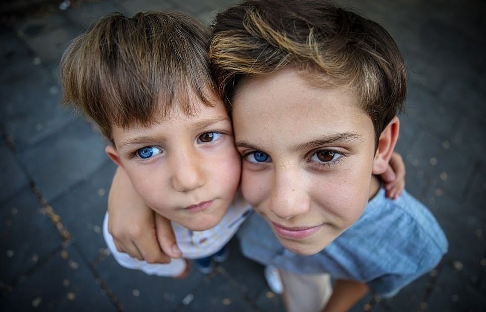 Близнецы бывшего читать. Братья из Турции с гетерохромией. Мальчик с разноцветными глазами. Дети с разноцветными глазами. Дети с разным цветом глаз.