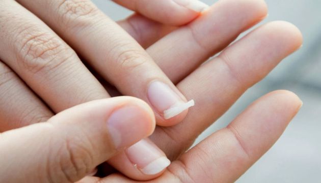 5 распространненых проблем с ногтями, их причины и решения