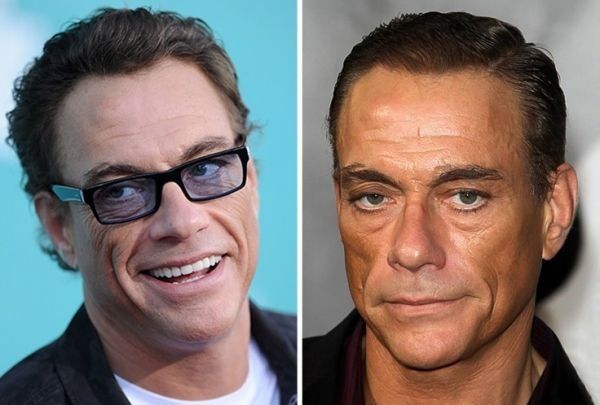 10 известных Голливудских мужчин, которые делали пластику лица и не скрывают этого