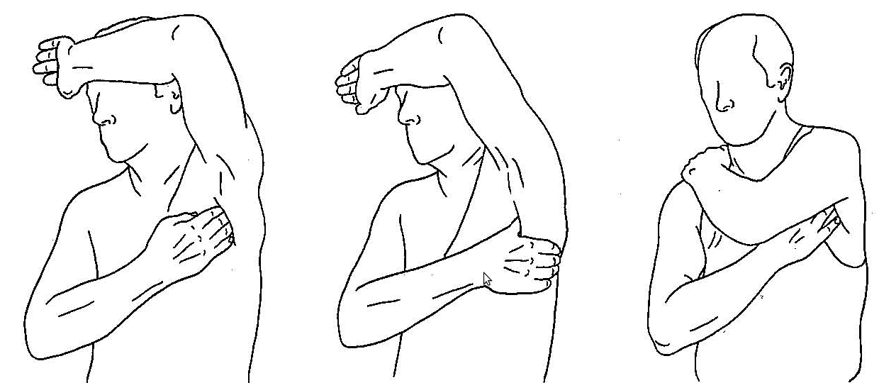 Болит левая сторона рука плечо