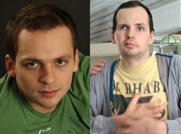 Алексей янин фото до и после инсульта Алексей янин фото до и после инсульта
